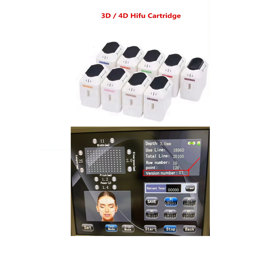 5D 3D 4D HIFU Kartusche /Vagin – Vaginal Tightening Hifu Machine Bewertung und Preis
