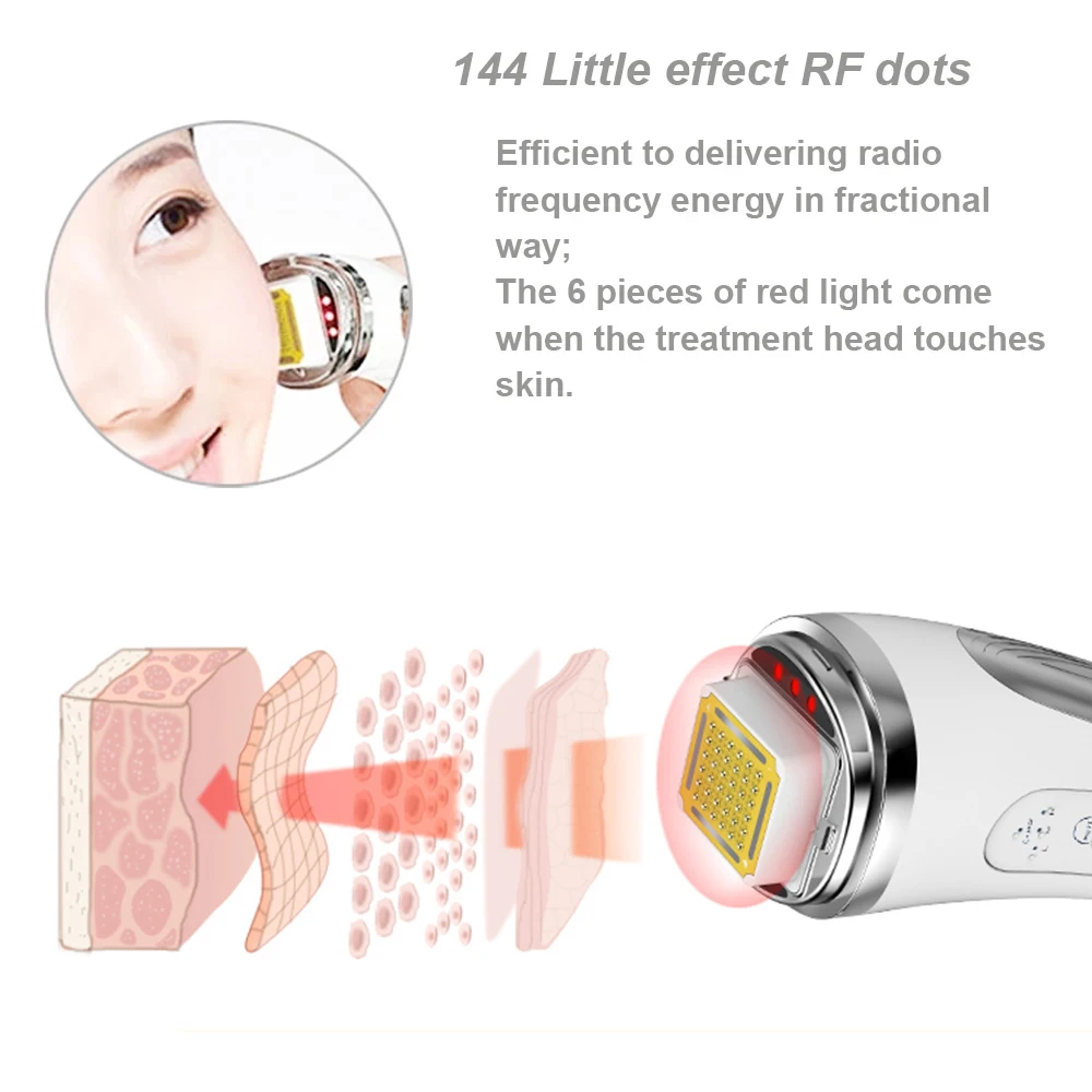 RF Radiofrequenz Gesichtsstraf – Radio Frequency Face Lift Machine Bewertung und Preis