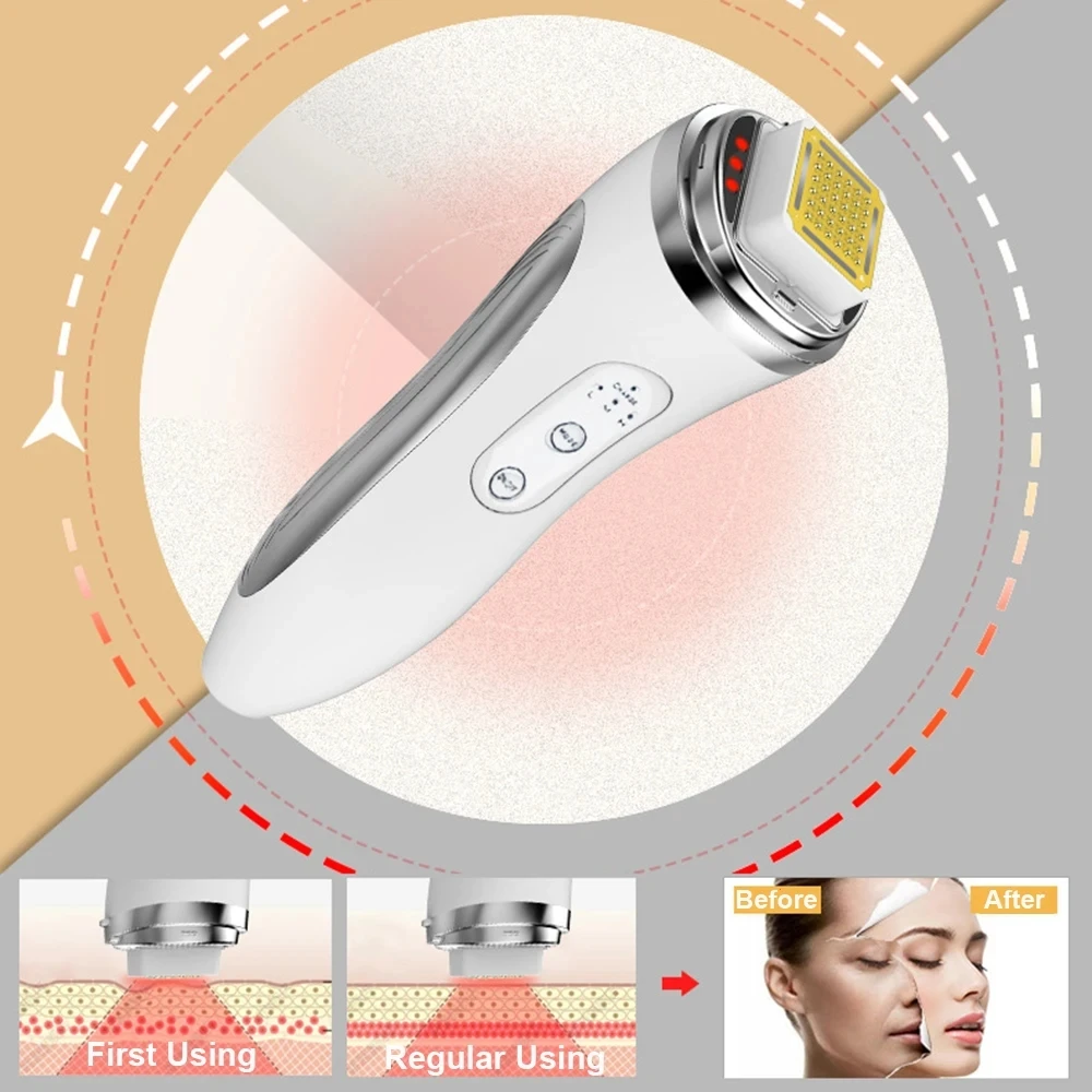 RF-Radiofrequenz-Gesichtsstraf – Radio Frequency Face Lift Machine Bewertung und Preis